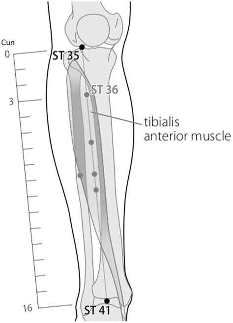 The Roles Of Battlefield Acupuncture And Electroacupuncture In A Patient With Cancer Related Pain Medical Acupuncture The Roles Of Battlefield Acupuncture And Electroacupuncture In A Patient With Cancer Related Pain Medical Acupuncture